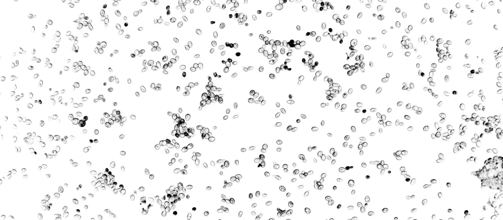 Wyeast Lab Report: Understanding Diastaticus